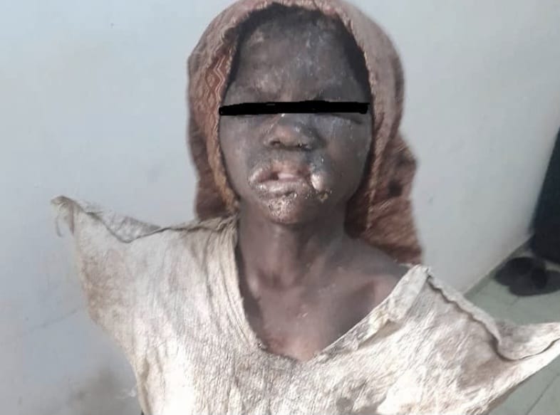 Côte d’Ivoire | Sévices corporels à mineure